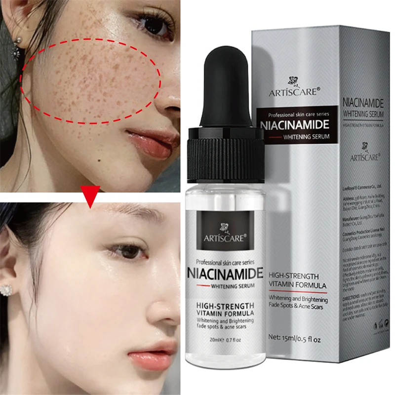 20ml Whitening Serum Remove Dark Spots Freckle Essence Anti-Aging Niacinamide Pigmentation Melasma Brighten Skin Care