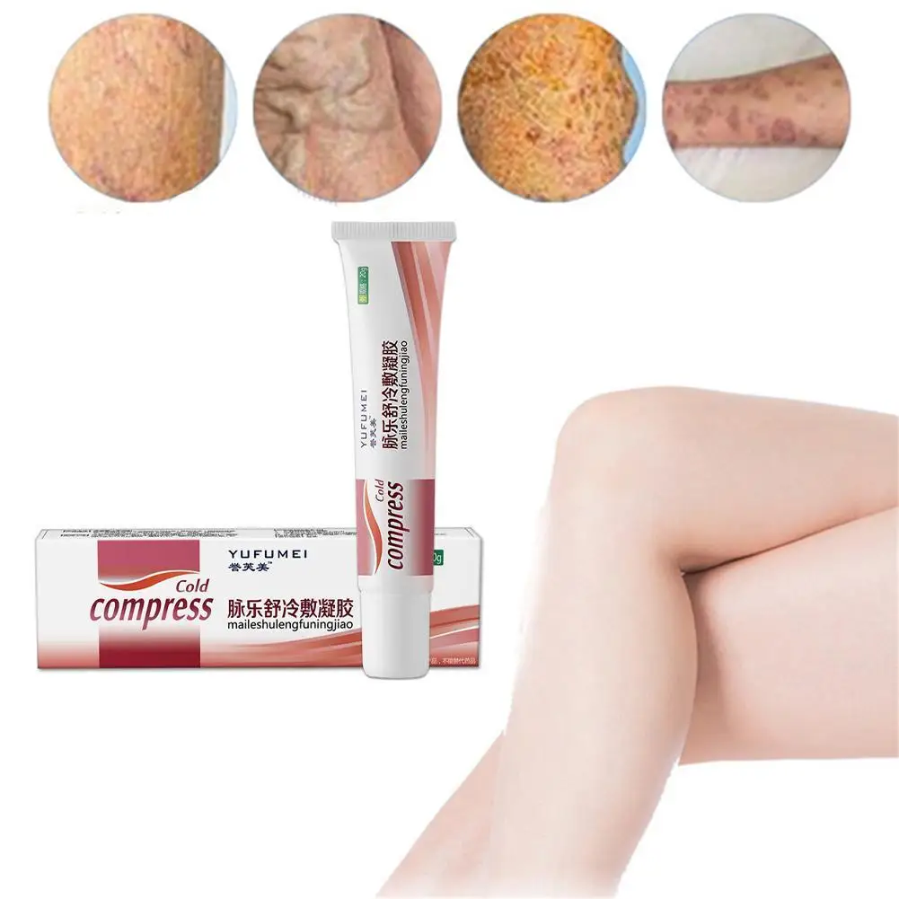 

20g Varicose Veins Ointmnet Vasculitis Phlebitis Medical Herbal Plaster Varicosity Cream Spider Angiitis Removal TY0P1