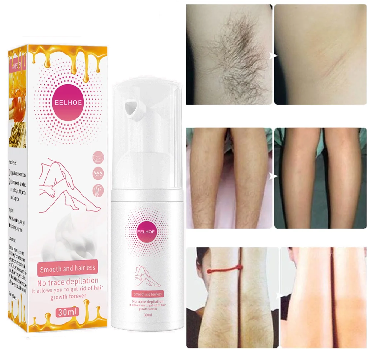 

Honey Hair Removal Spray Hair Growth Inhibitor Armpit Legs Arms Painless Hair Remover Cream Gentle Non-irritating Man Woman Care