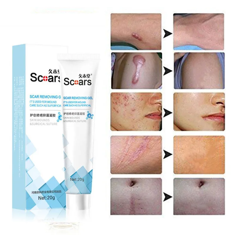 

Herbal Scar Removal Cream Gel Repairing Pock Mark Burn Surgical Scar Cesarean Scar Stretch Marks Smooth Moisturizing Skin Care