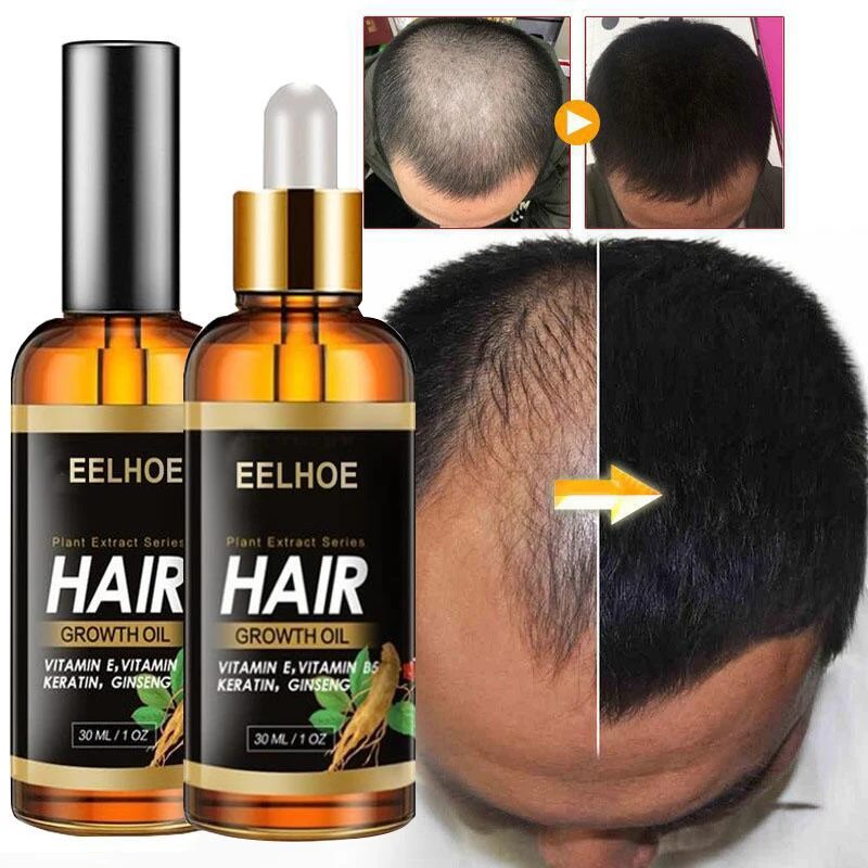 

Hair Growth Essential Oil Products Anti Hair Loss Spray Serum Ginger Treatment Dry Frizzy Damaged Thin Hair Nourish Beauty Care