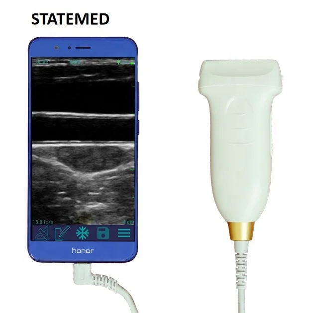 

Popular portable CE USB array linear probe type mini ultrasound scanner machine