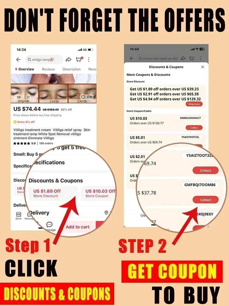 ГОРЯЧАЯ ПРОДАЖА новинка эффективно удаляет витилиго мазь крем червяк удаление