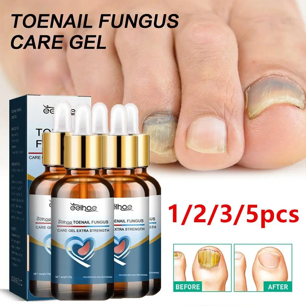 

1/2/3/5 шт., антиинфекционный гель для ногтей