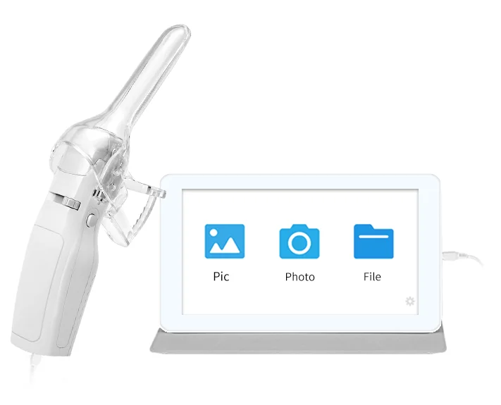 

Household Portable Medical Device Miniscope Self Exam Mini Digital Video Cameras Colposcopio Colposcope For Gynecology