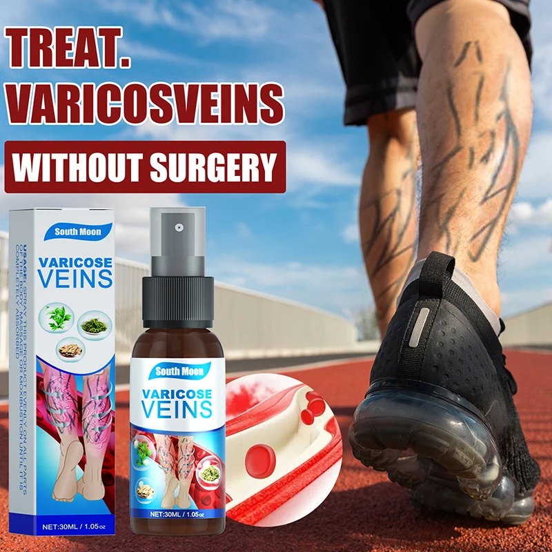 

30ml Varicose Vein Treatment Spray Smooths Blood Vessel Bulges Earthworm Legs Relief Massage Intravenous Spray Leg Care Tools