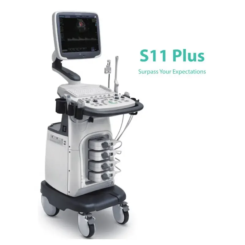 Ультразвуковой сканер Sonoscape S11 Plus