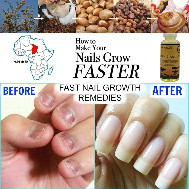 

Natural Cuticle Oil Fast Nail Growth The Secret To Get Longer Stronger Healthier Fingernails Ayurvedic Herbs for Cracked Brittle