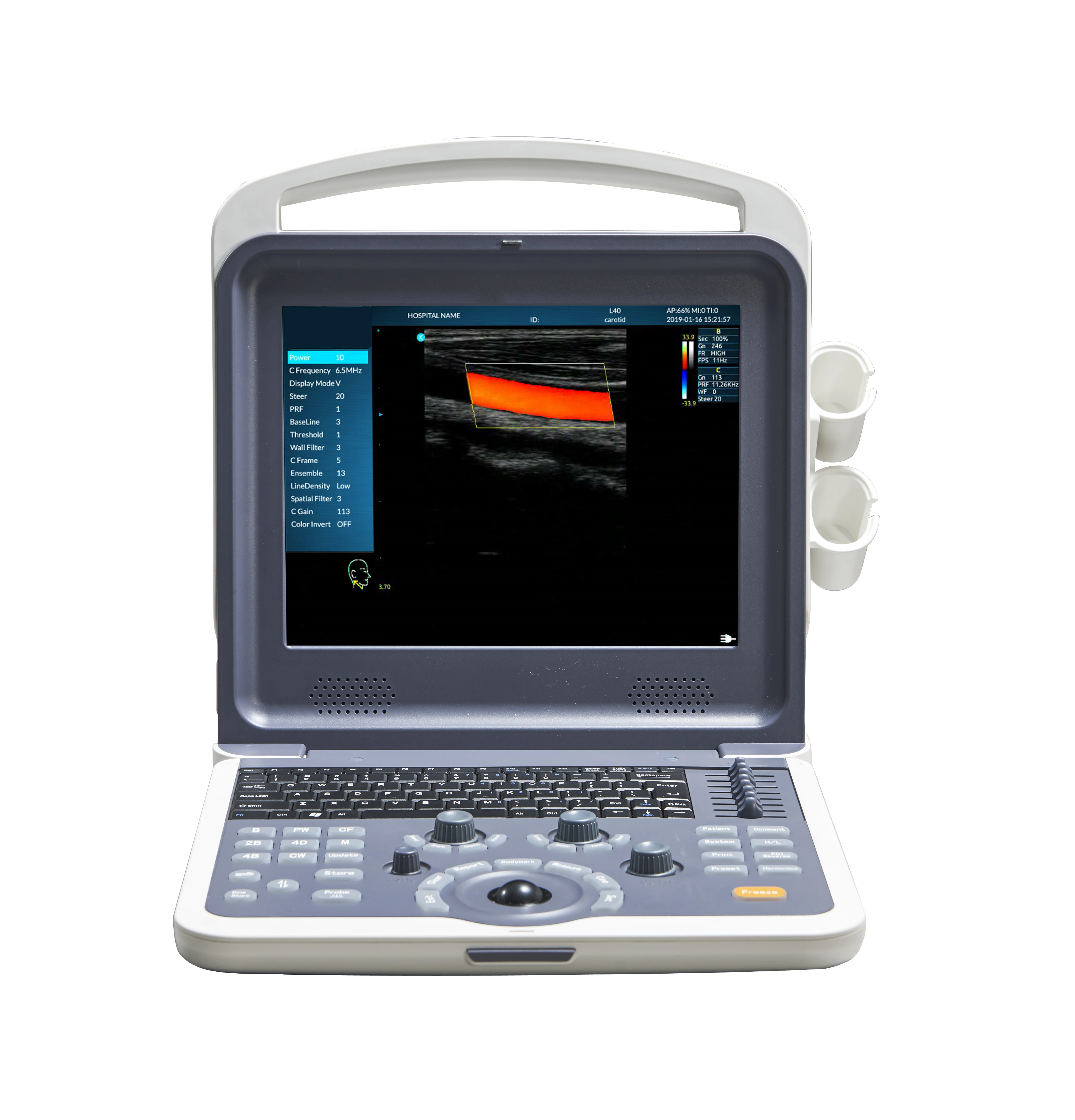 

Obstetric ultrasound color doppler machine china ultrasound device transducer price