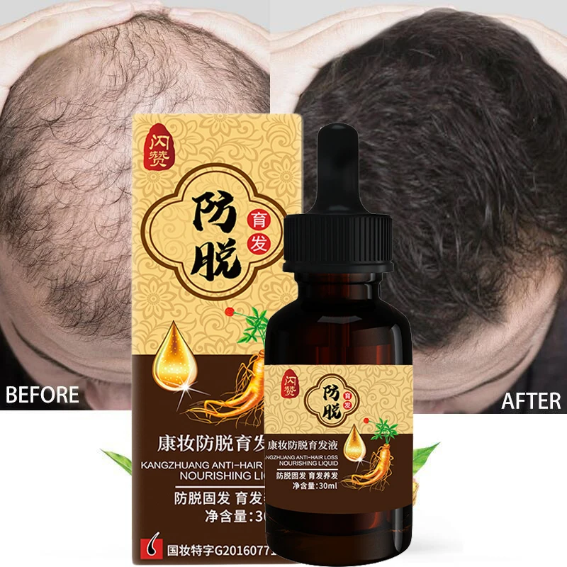 

Effective Ginger Fast Growing Hair Essential Oil Prevent Hair Loss Oily Scalp Treatment Care Men Women Hair Growth Products 30ml