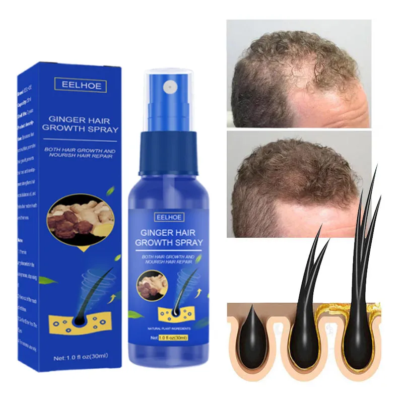 

Эффективное лечение для мужчин и женщин, эссенция для роста волос, спрей для филировки, лечение волос для мужчин и женщин, продукты против вы...