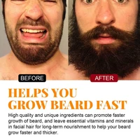 30ml practical safe ingredient convenient soften hair scalp care growth liquid for male hair essence beard essence