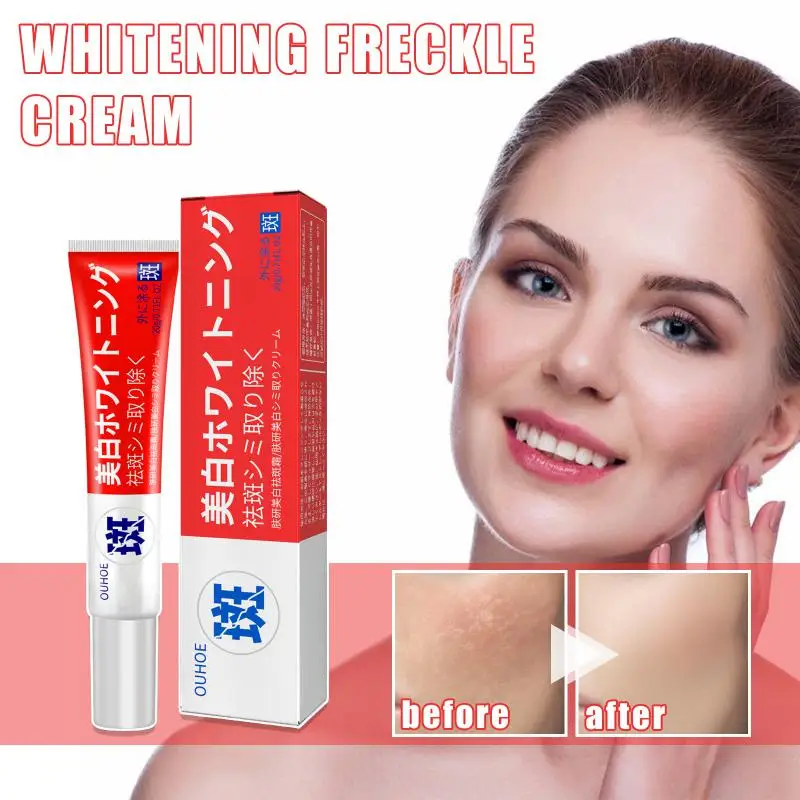 

Крем для кожи вокруг глаз, от Тёмных кругов и мешков