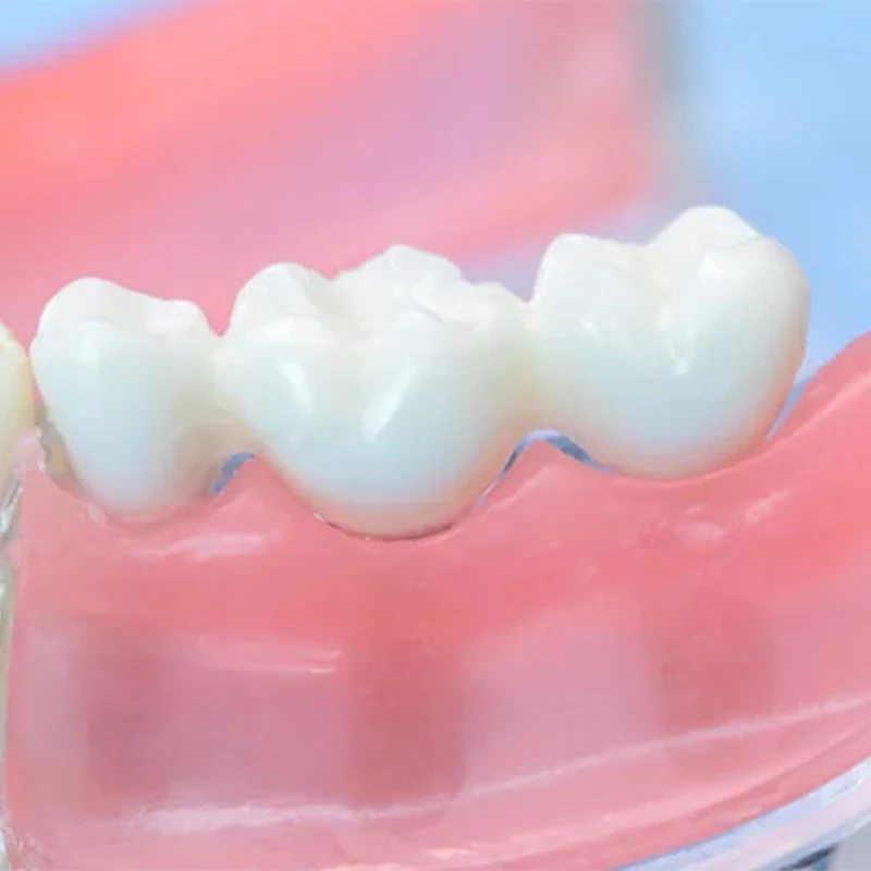 VVDental стеклоиномер цемент склеивание тип I бутылка восстановление зубов материал