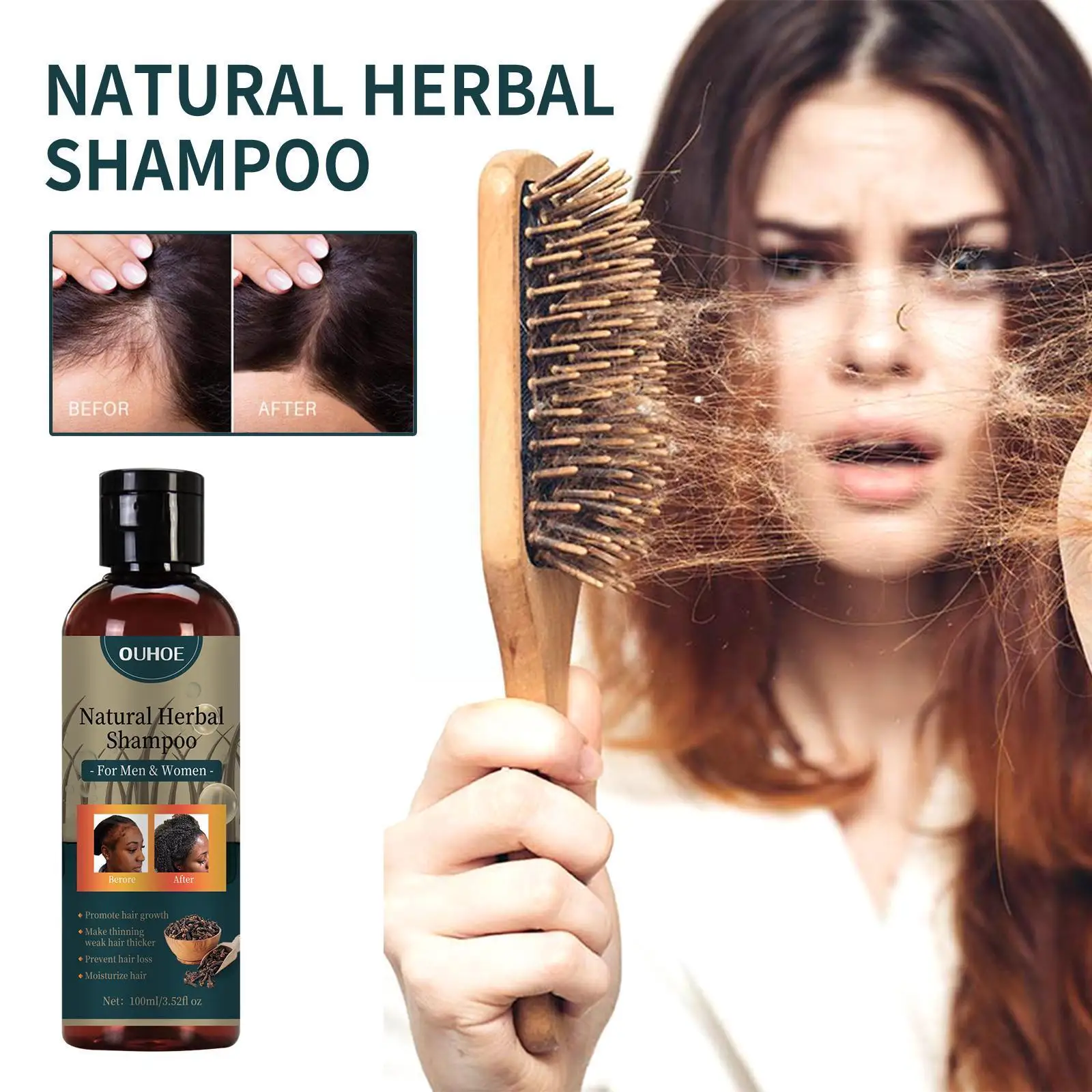 

Ginger Herbal Shampoo Hair Growth Anti-hair Loss Anti-itch Loss Ginger Anti-dandruff Refreshing Darkening Control Oil-contr G3O2