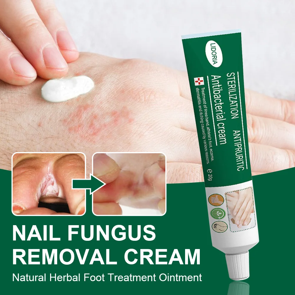 

Nail Fungus Removal Cream Natural Herbal Foot Treatment Ointment Cracked Peeling Onychomycosis Paronychia Repair Feet Care