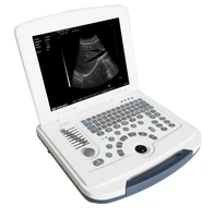2020 ecography usg ultrasound machine price