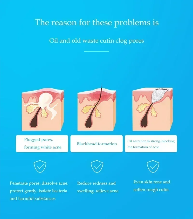 Раствор с салициловой кислотой 10 мл