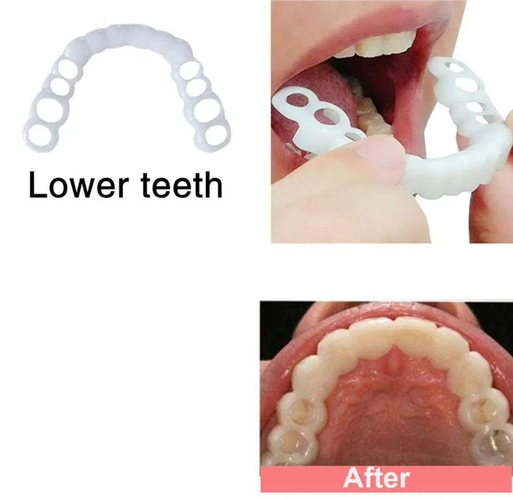Cubierta de dientes postizos, blanqueador, a presión, cuidado de la dentadura