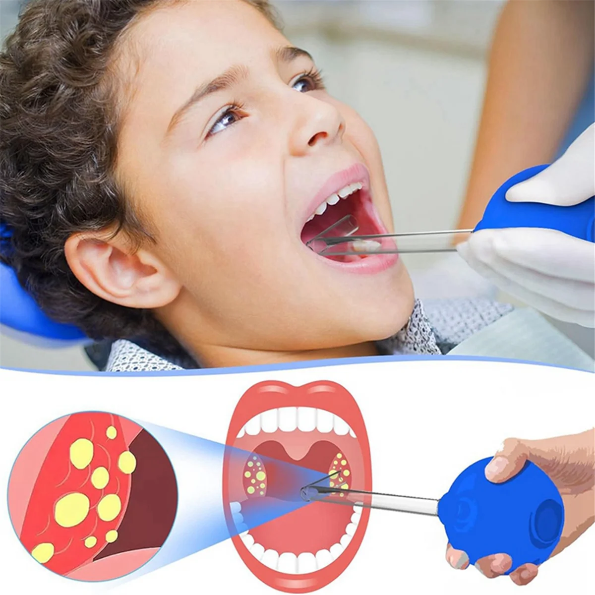 Вакуумный инструмент для удаления миндалин набор ручная стильная очистка рта