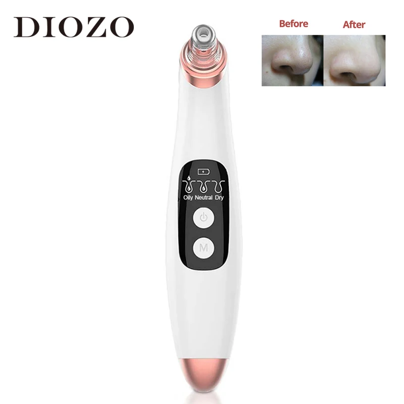 

Устройство для удаления черных точек на лице, с зарядкой от USB