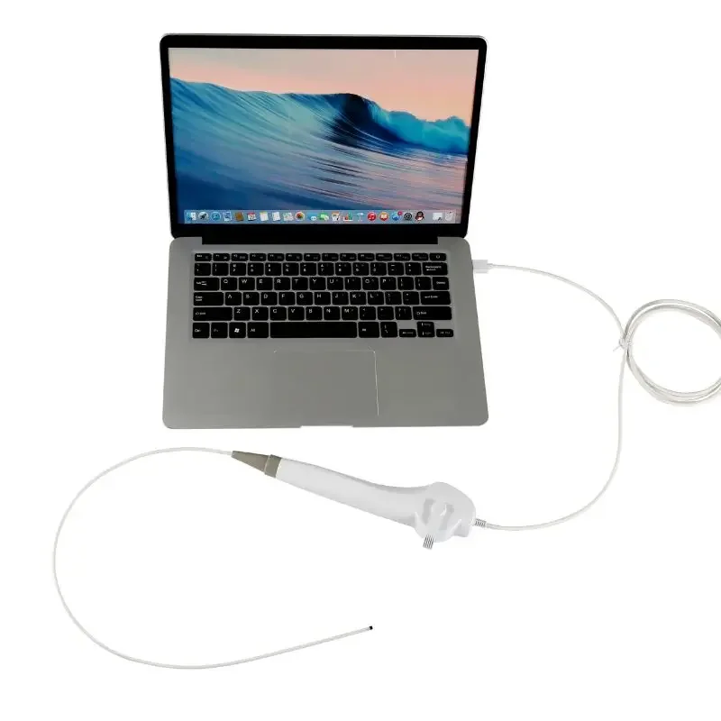 Эндоскоп ENT-BESDATA оптовая цена USB-эндоскоп ENT медицинская камера для ушей носа горла