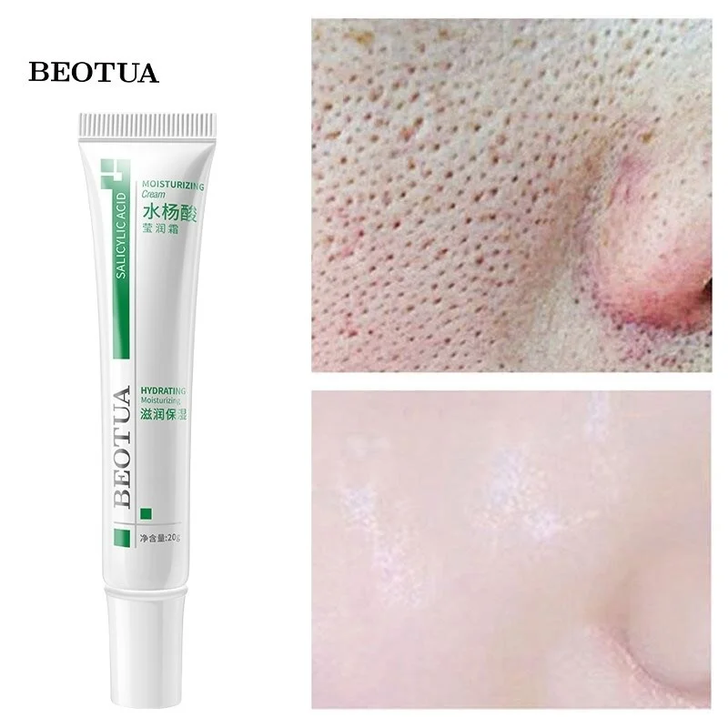 

Salicylic Acid Shrink Pores Face Cream Blackheads Remove Serum Acne Treatment Oil Control Moisturizing Firm Whitening Skin Care