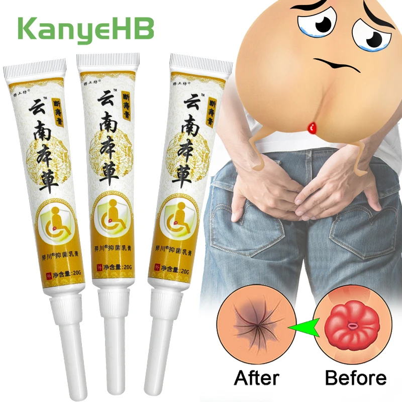 3 шт. китайский травяной крем от геморроя