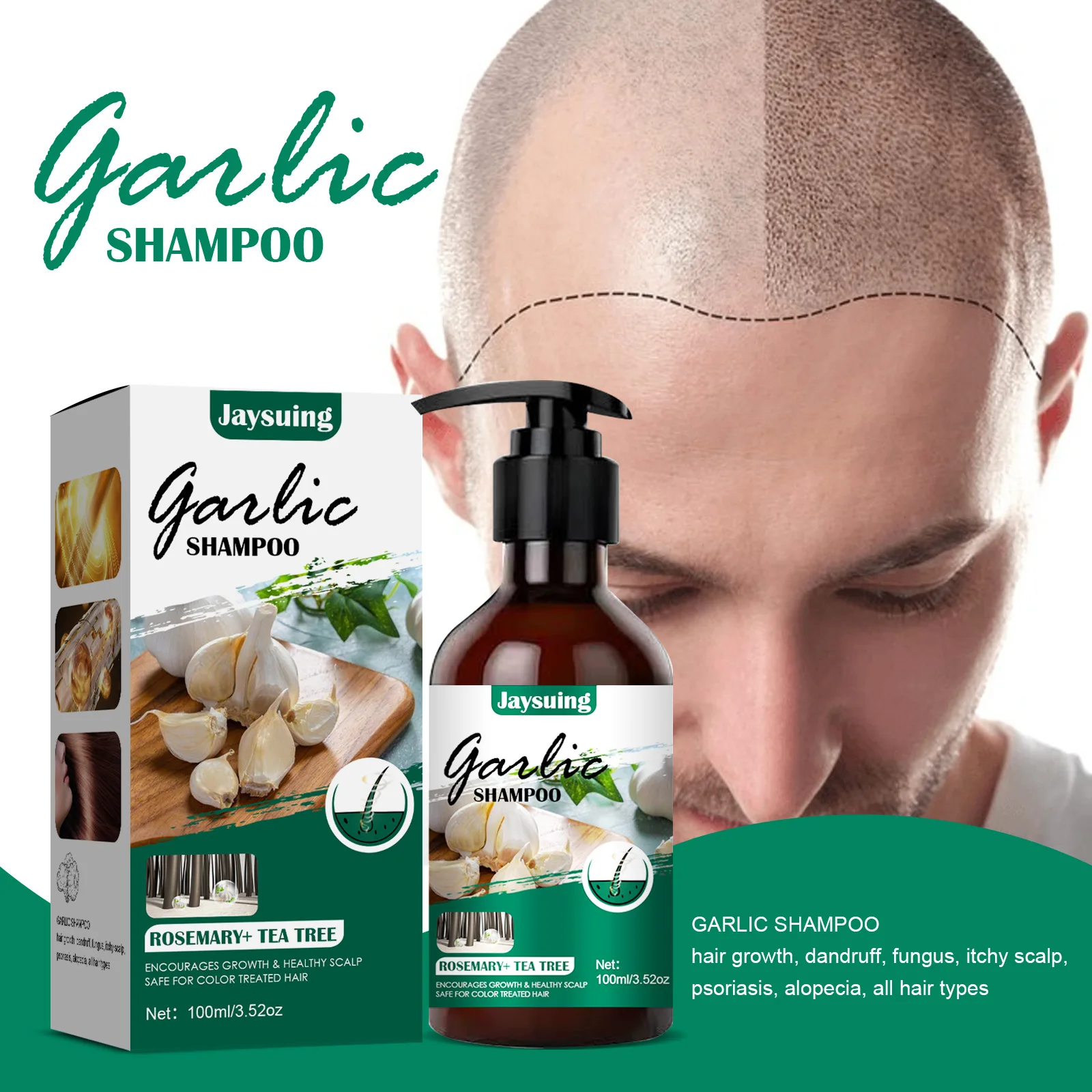 Jaysuing garlic shampoo anti-hair loss nourishing shampoo hair itchy stop itching dandruff shampoo hair shampoos