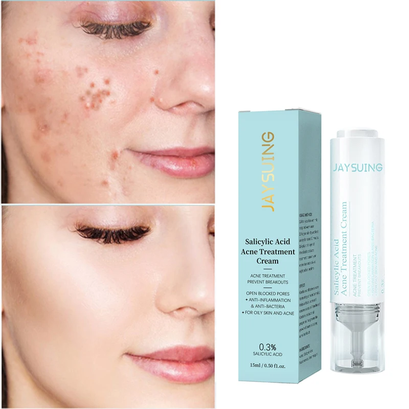 

Salicylic acid acne whitening cream for blackhead repair, disappearance and pore shrinking acne treatment