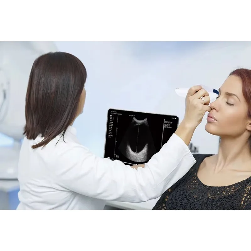 Фото SY-AM01 Беспроводной зонд Офтальмологический сканер Микровыпуклая карман для ладони №5