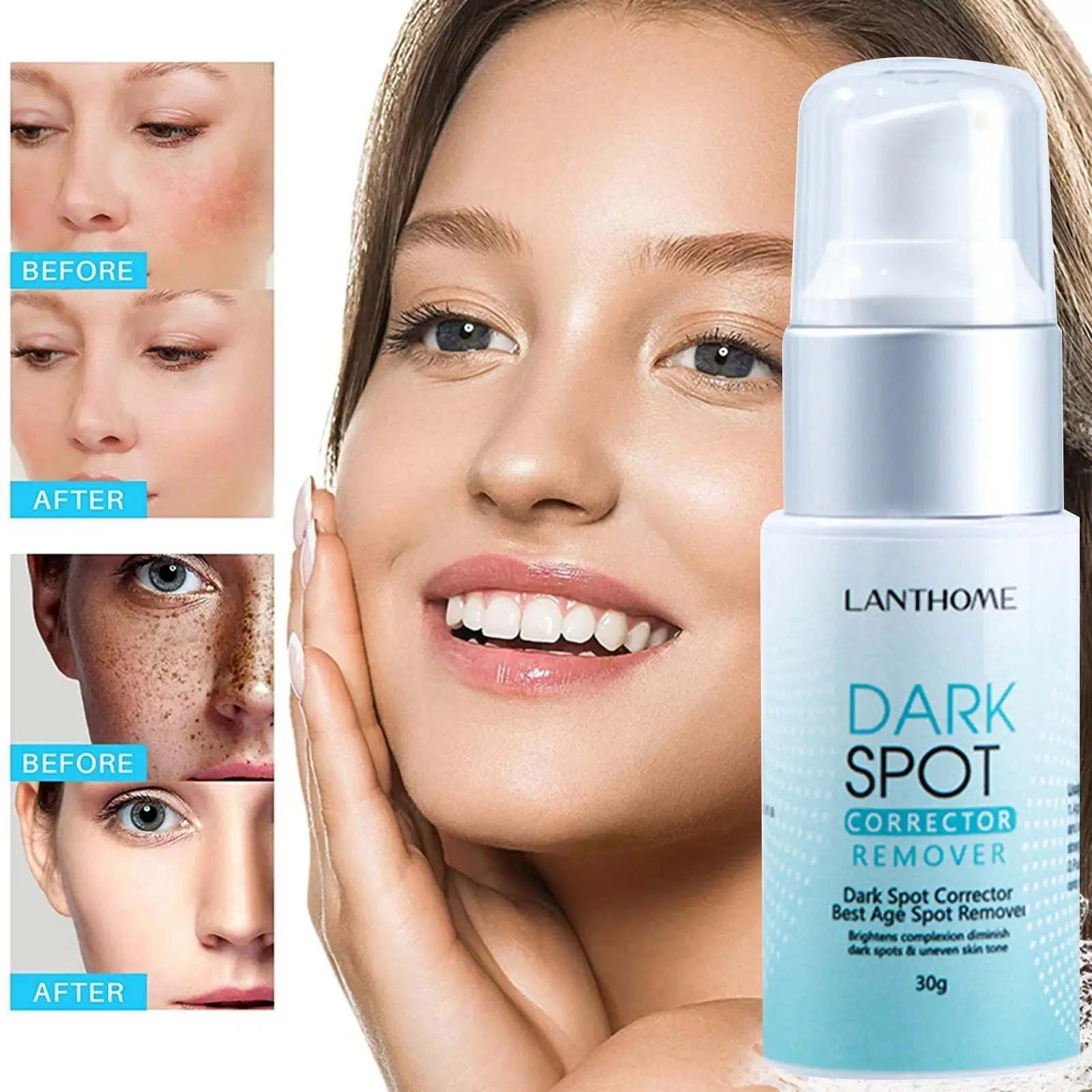 Lanthome Dark Spot Cream Remover Corrector, Whitening Barrier From Skin And And Expelling Toxins Moisturizing, Pores Improv O2B5