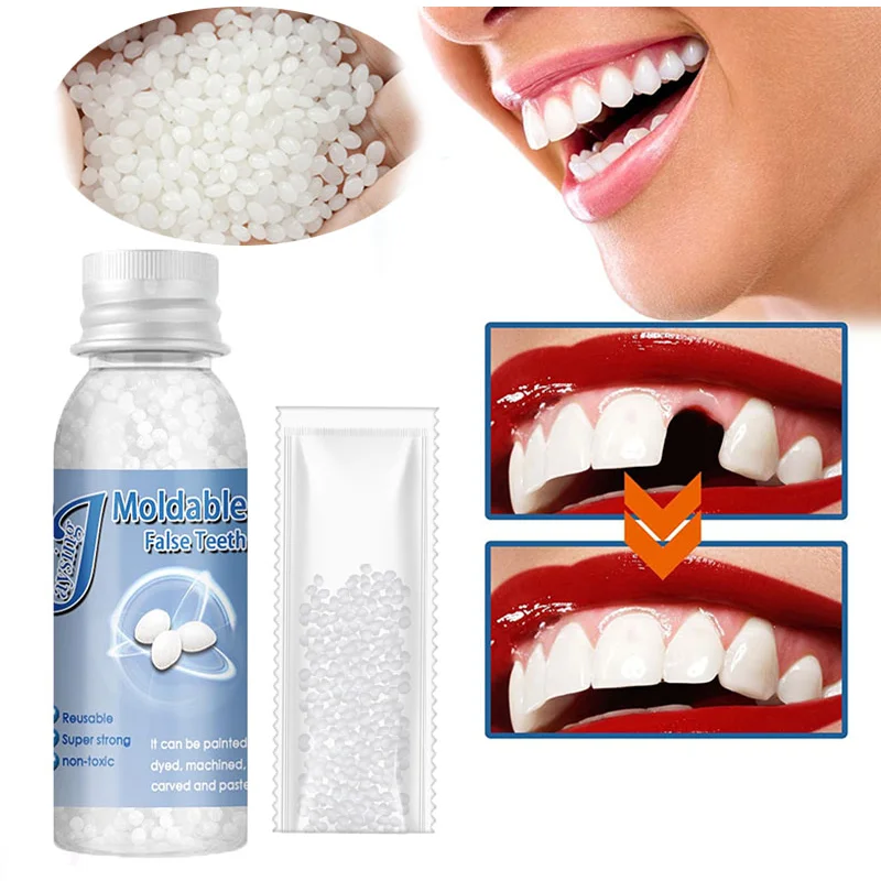 Temporary Resin Tooth Repair Glue Shapeable Falseteeth Gaps Filling Solid Glue Fake Teeth Repair Glue Safety Dental Supplies