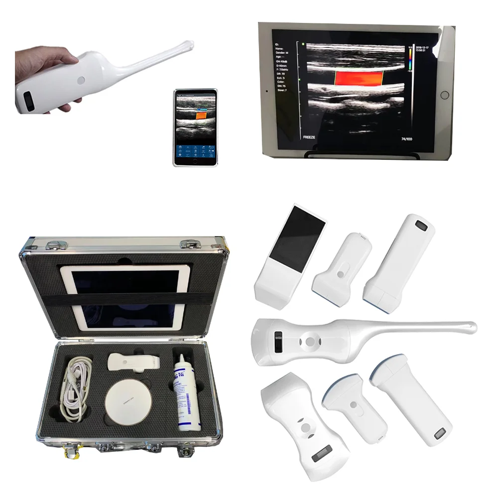 Цветной Допплер suresults портативный беспроводной ультразвуковой сканер для оценки