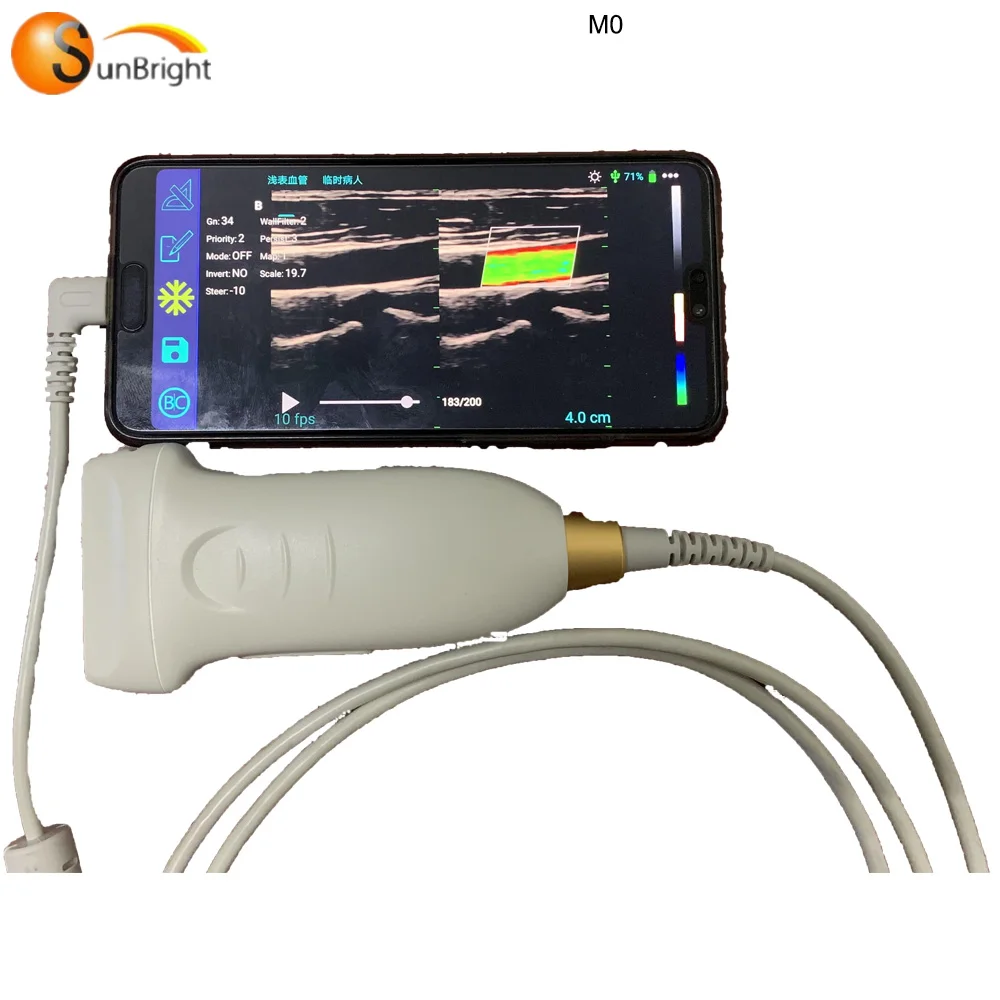 Беспроводной ультразвуковой линейный зонд с цветным потоком USB-зонд 128
