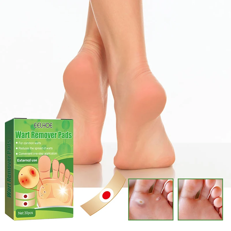 

30Pcs Medical Corn Plaster Wart Remover Pads Warts Thorn Killer Plantar Calluses Callosity Patch Detox Foot Protector Stickers