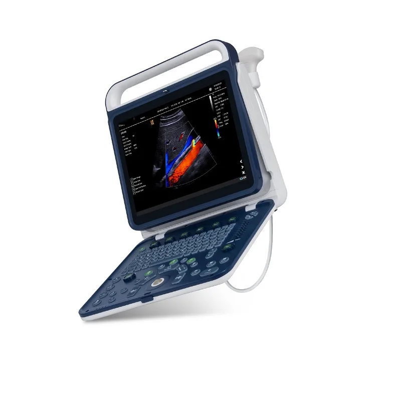 

Portable Color Doppler Ultrasound System For Accurate Medical Diagnosis