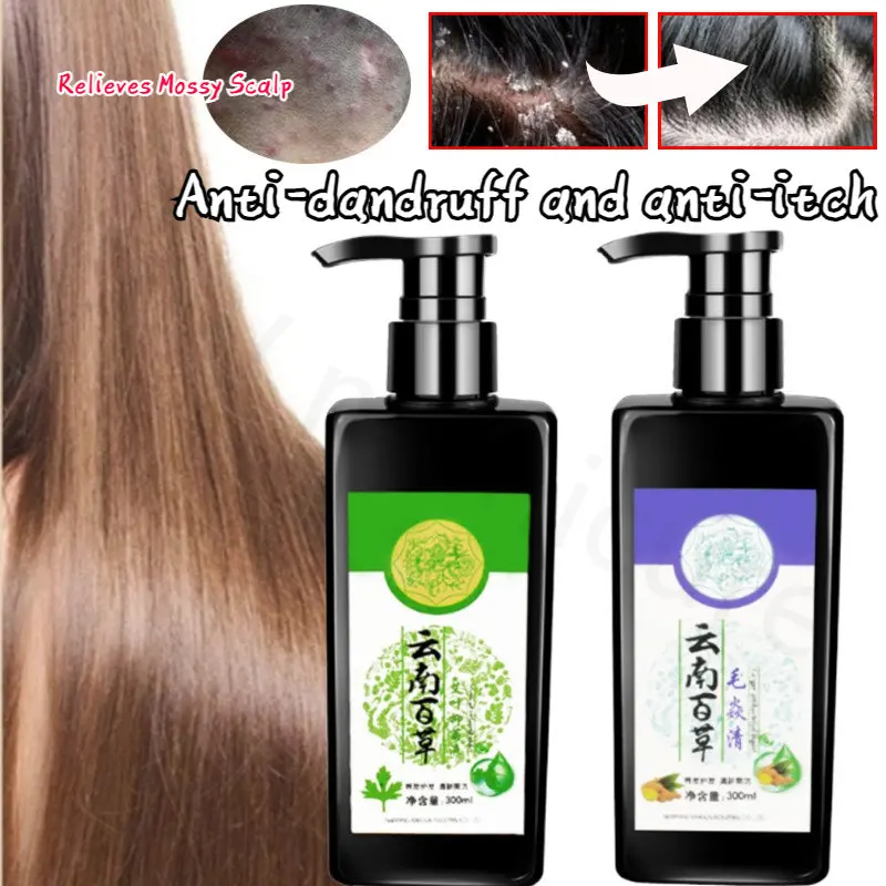 

Relieve Folliculitis Anti-dandruff Anti-itch Control Oil Go Eat Tinea Capitis Scalp Cleansing Shampoo Deeply Repairs The Scalp