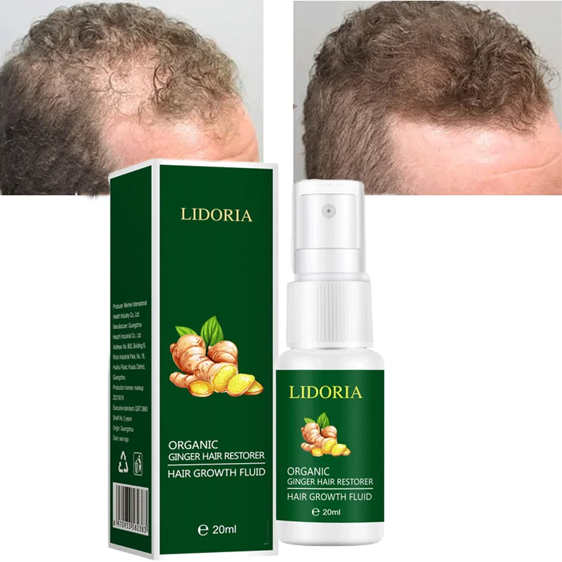 

Ginger Hair Growth Spray Natural Anti Hair Loss Products Nourishes Scalp Repairs Dry Damaged Hair Prevent Baldness Treatment