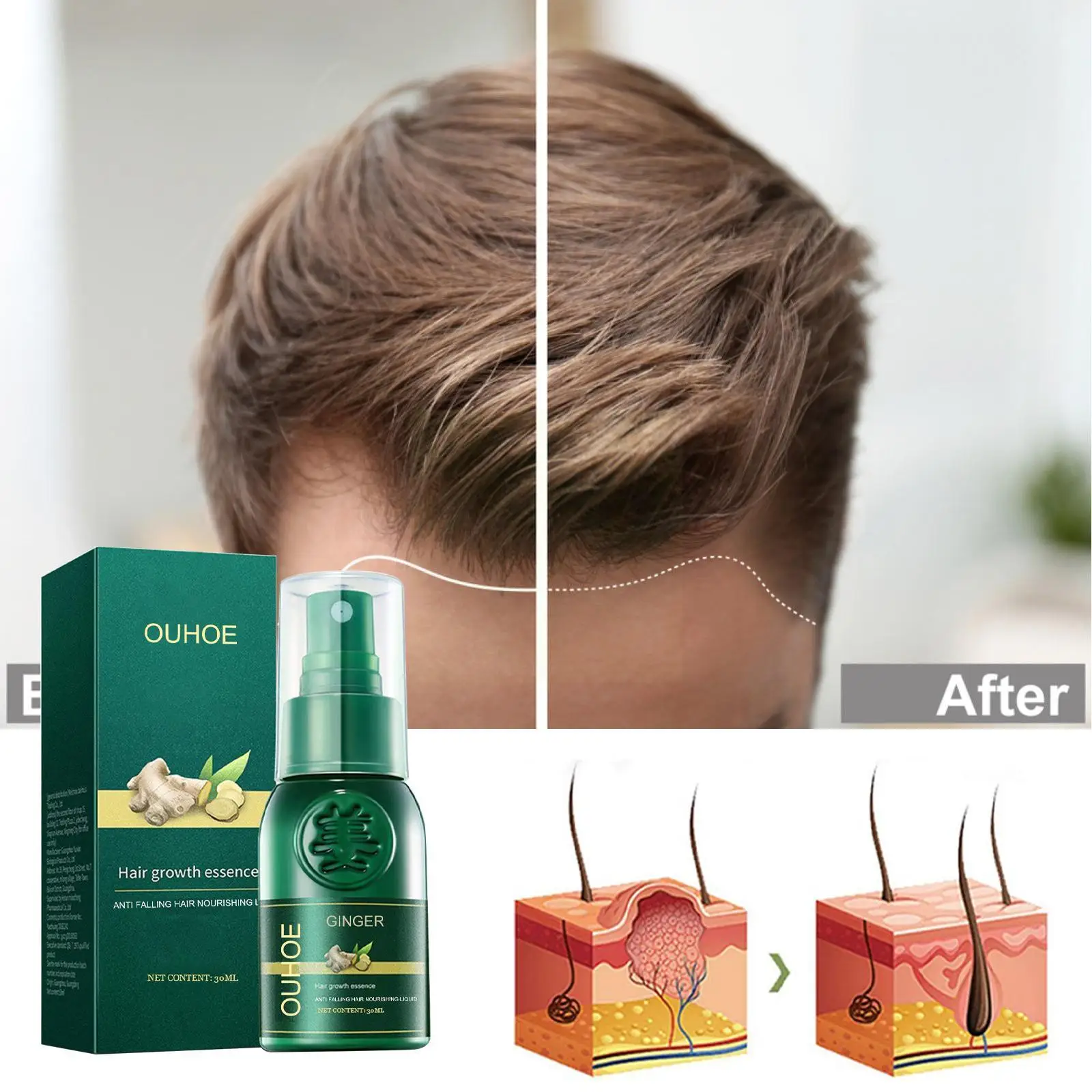 

Ginger Hair Growth Essential Oils Serum Anti Hair Loss Beauty Care Ginger Products Extract Growing Fast Treatment Growing H I2E6