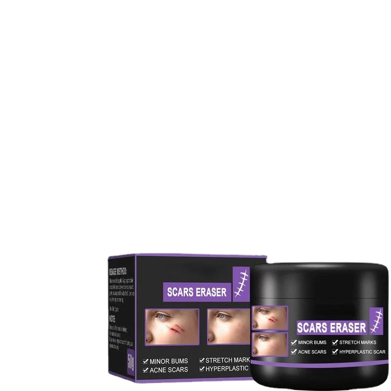 

Scar repair cream desalt postoperative scars, smooth skin, repair skin wounds, moisturize skin care cream