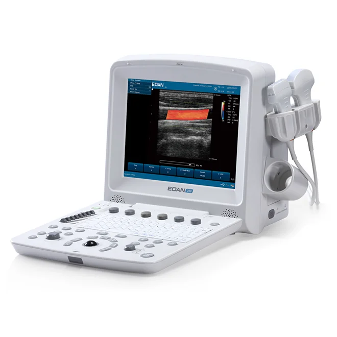 

EDAN portable Doppler ultrasound machine EDAN U50