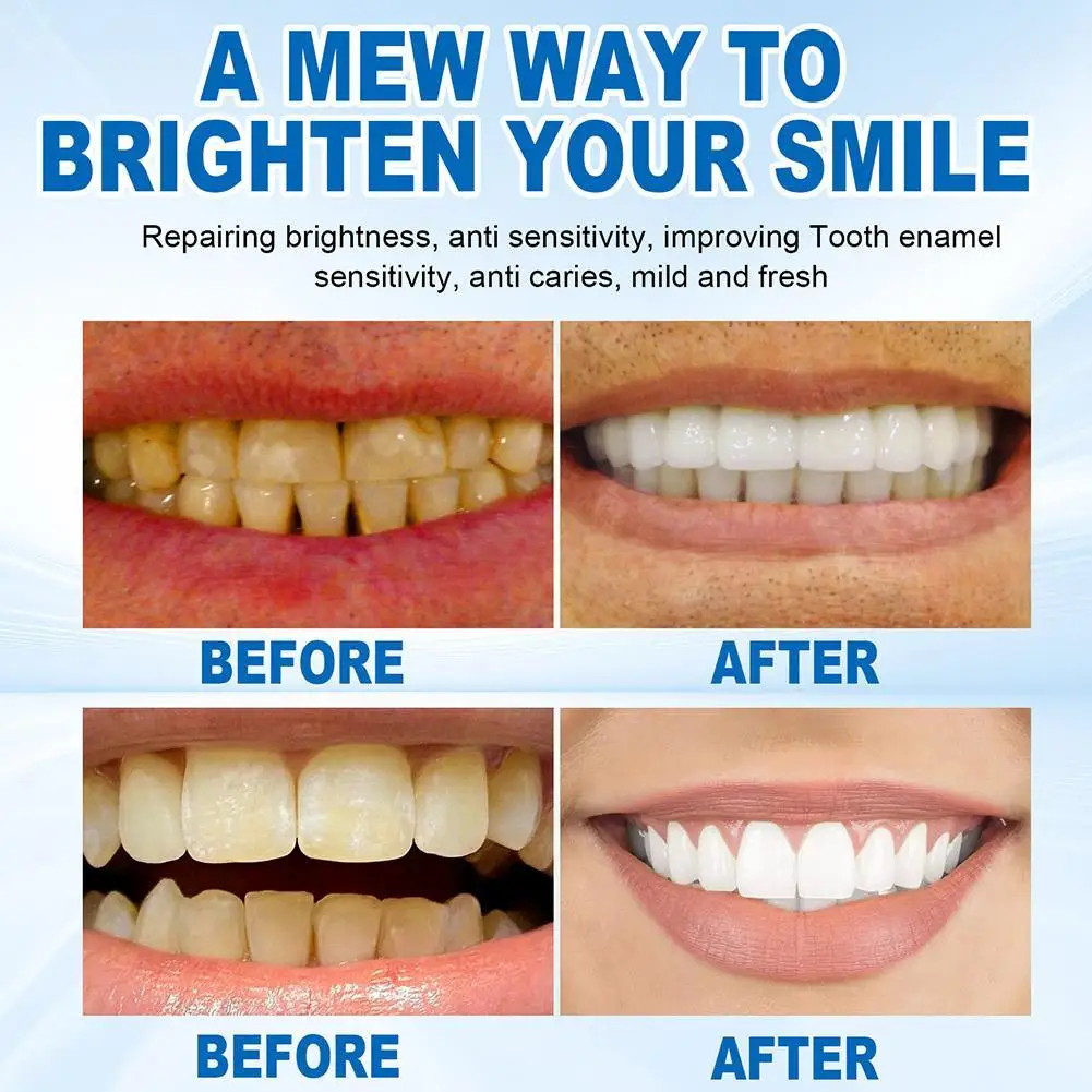 Рисунок 3 - Отбеливающая зубная паста