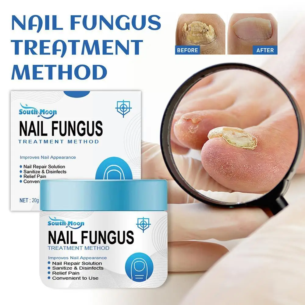 

Уход за ногтями противогрибковый гель для восстановления ногтей естественное восстановление лечение бактерицидный противогрибковый крем для ногтей N0Q9