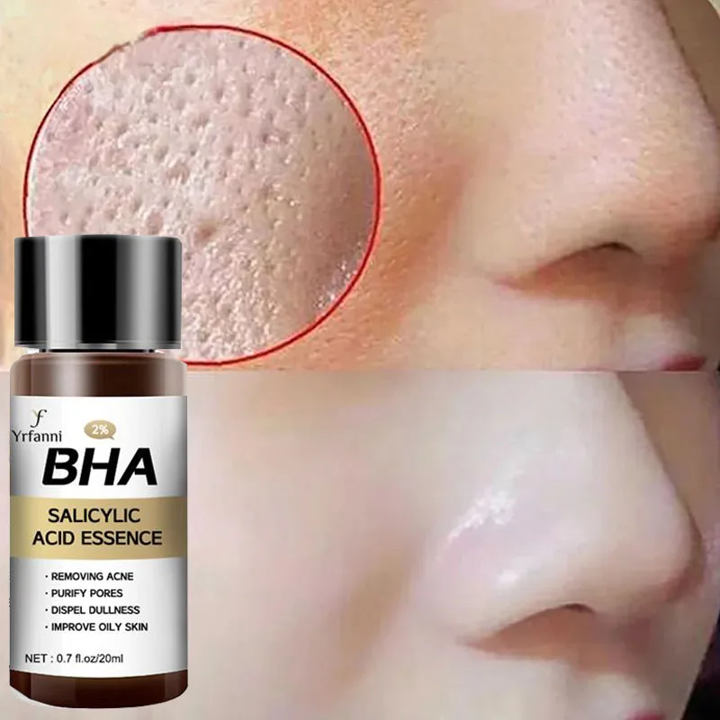 

Pore Shrinking Face Serum Firming Smooth Pores Exfoliating Oil-Control Hydrating Pores Repair Essence Beauty Health Skin Care