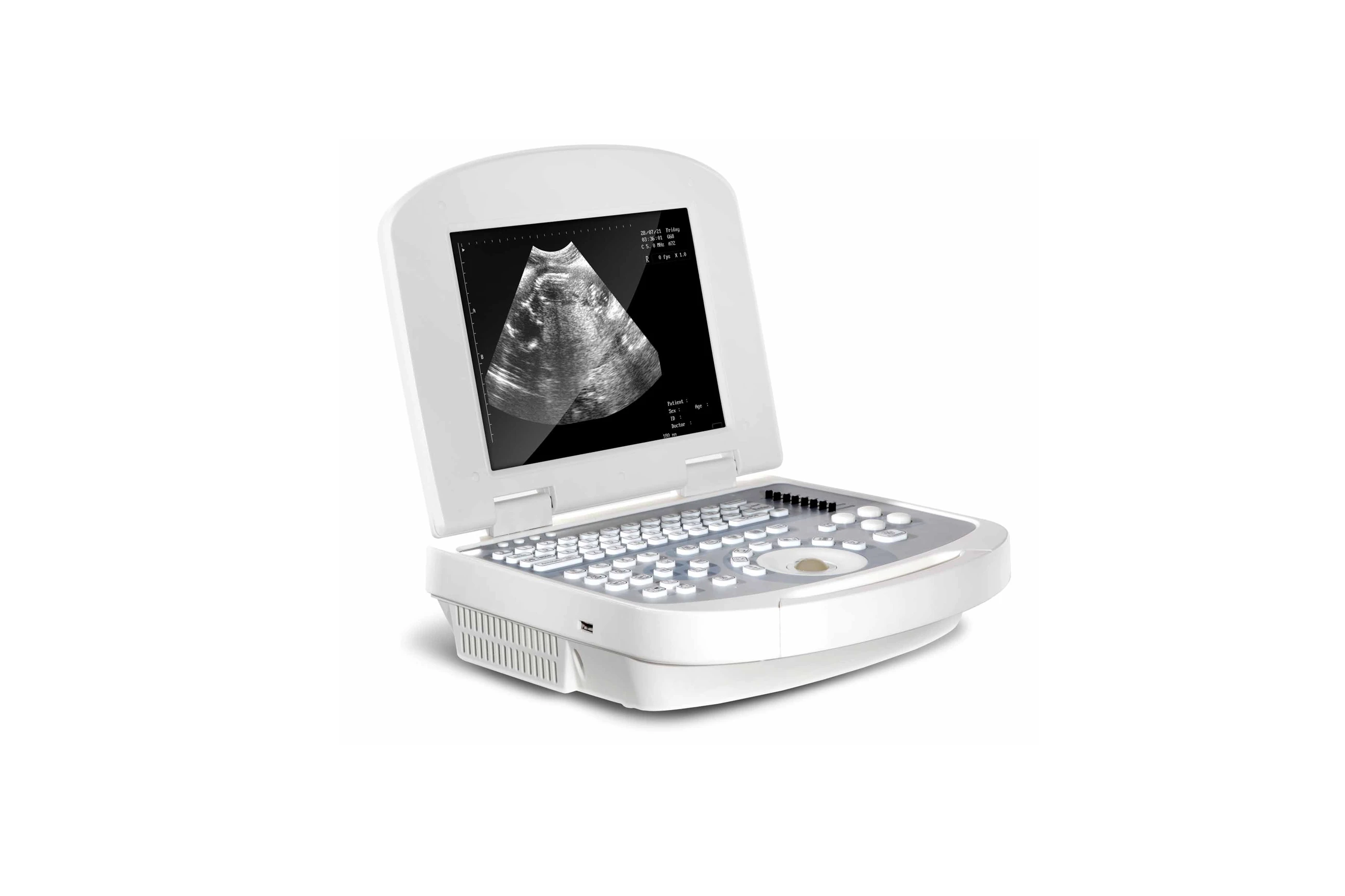 ультразвуковой бокс. B ultrasound. Non-invasive. Portable digital color doppler ultrasound system s9. аппарат узи digital color doppler ultrasound system model s15.