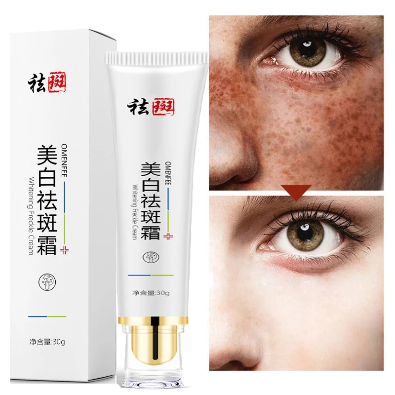 10PCS Whitening Freckle Cream Remove Melasma Acne Spot Pigment Melanin Dark Spots Pigmentation Moisturizing Gel Korea Skin Care