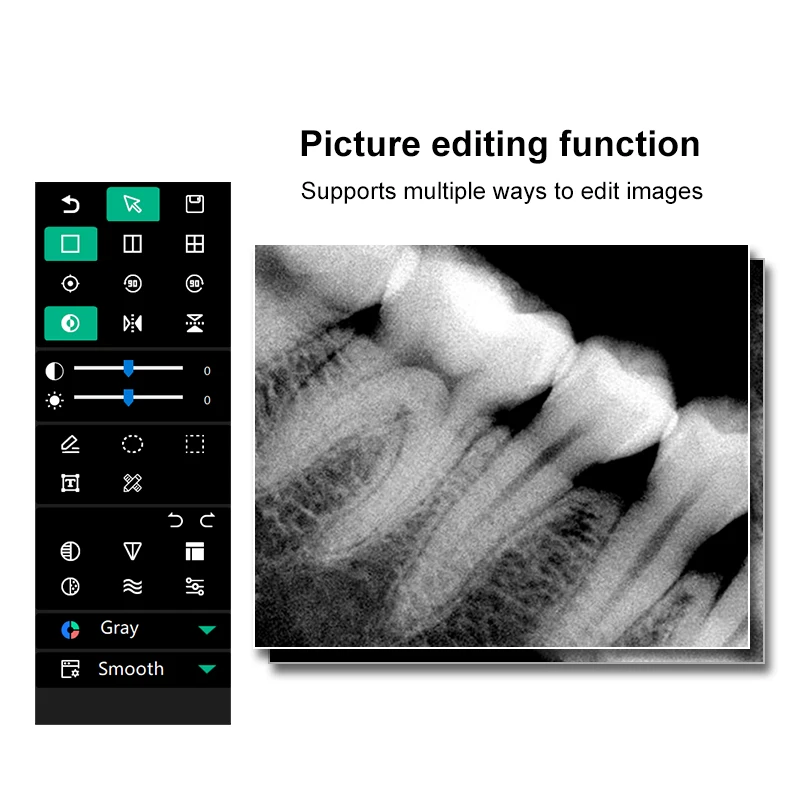 Цифровой рентгеновский датчик VV Dental для быстрой визуализации полости рта у детей и взрослых, портативное стоматологическое оборудование для клиник (art.: 3920da330bdee) - 3920da330bdee