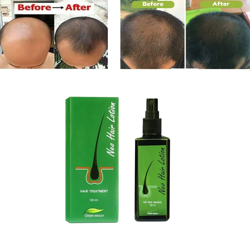Thailand Original NEO Hair Growth Lotion Spray Long Hair Lotion Spray Nourishing Scalp Strengthening Hair Growth Hair Care Serum