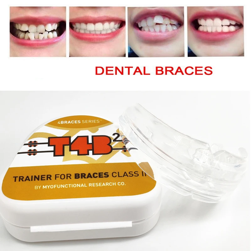 

Australia Original Myobrace T4B2 Trainer for Braces Class II/MRC Orthodontic Appliance T4B2 Teeth Trainer Alignment for Sale